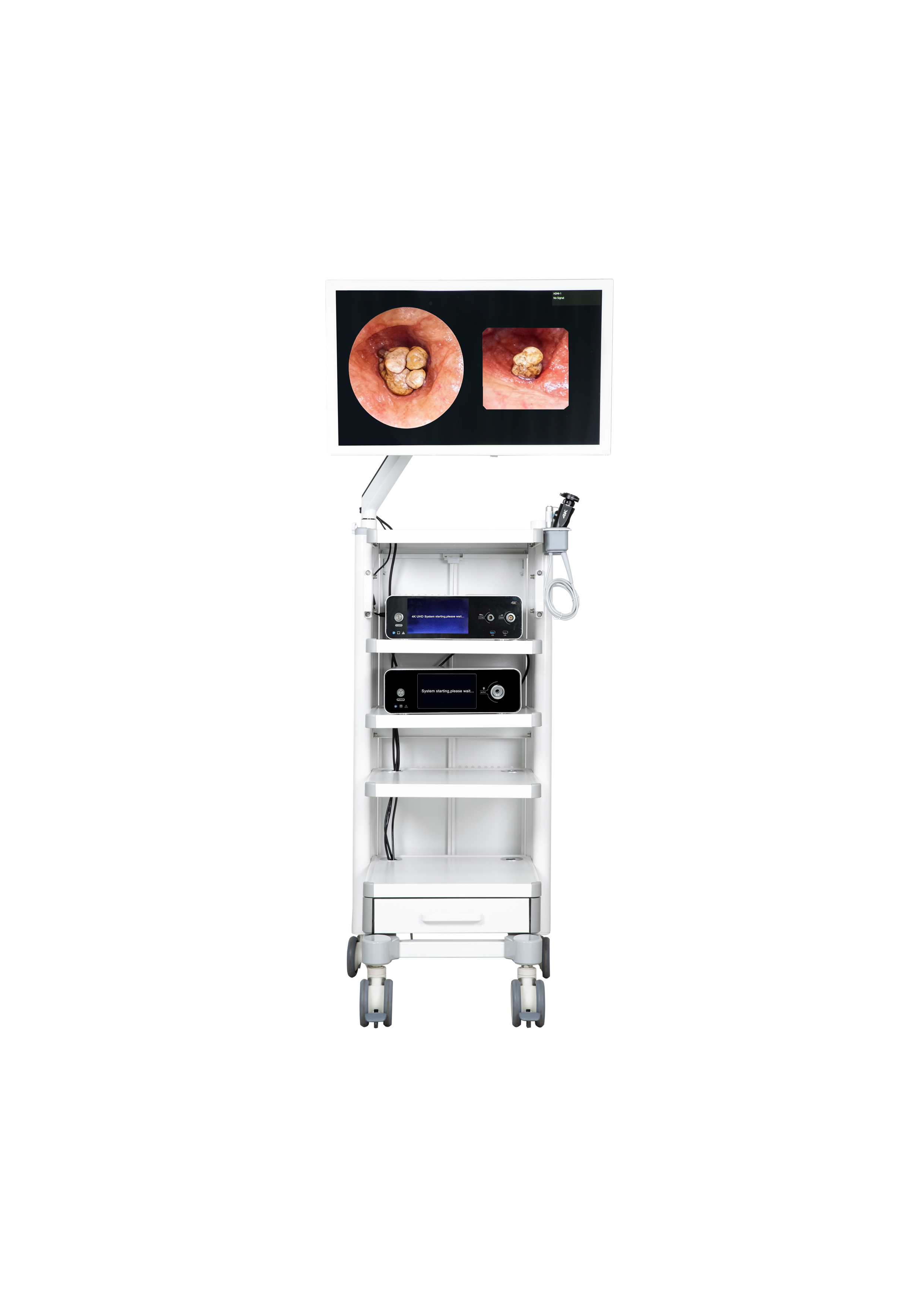 4K医用内窥镜摄像系统